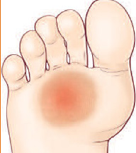 chir_hallux_5.jpg